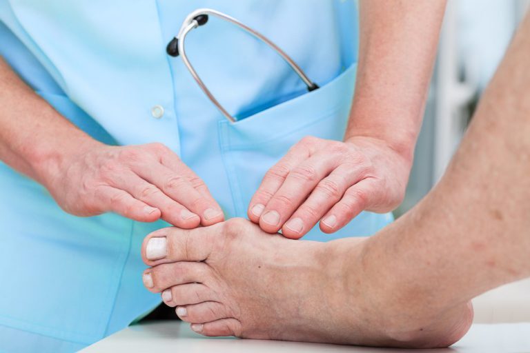 Minimally Invasive Bunion Surgery
