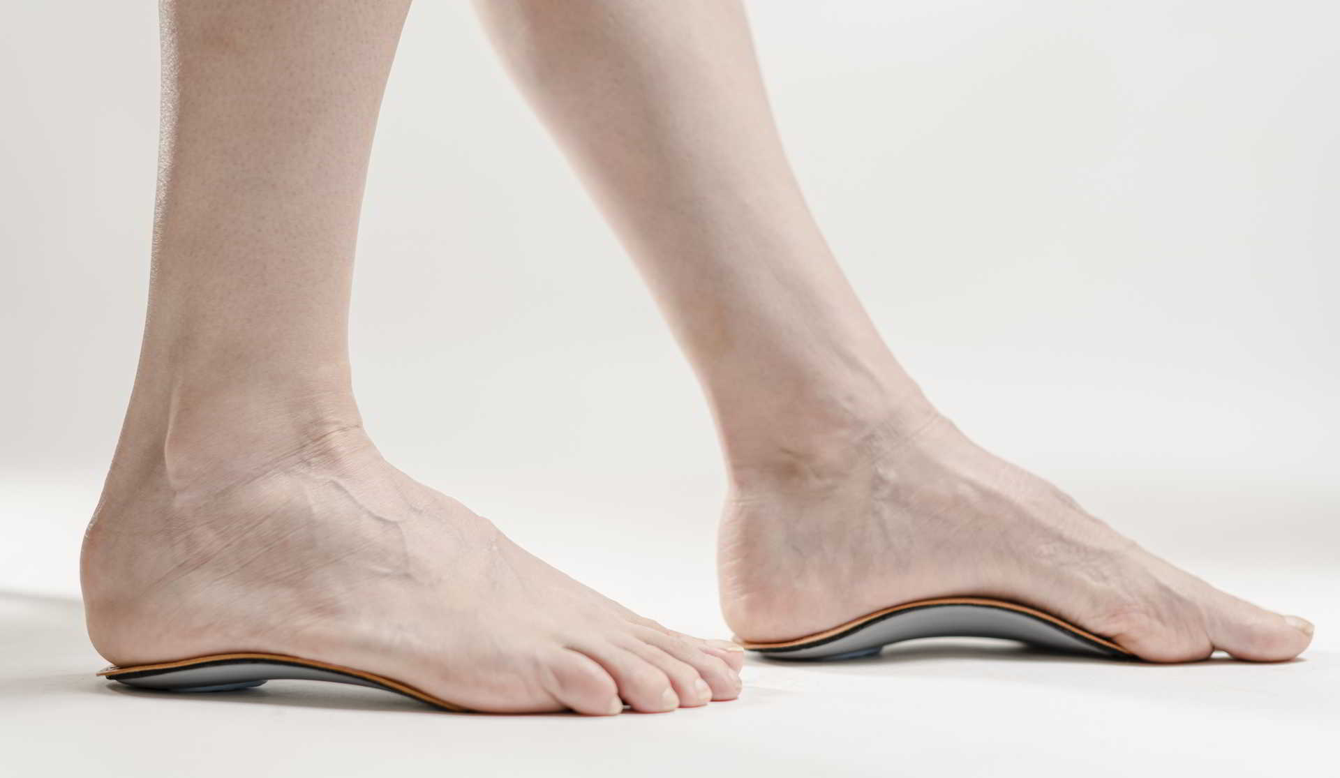 Bunion Revision Surgery Miami Dr. Ray Lopez DPM