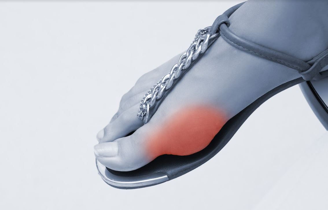 The Best 6 Sandals for Supination | Viakix