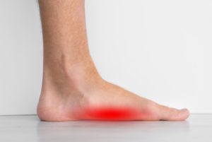 Flat Feet Surgery - How Painful Is It