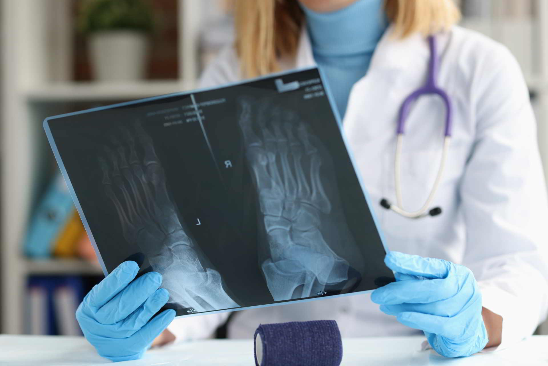  Doctor traumatologist examines x ray of feet foot pain causes and treatments concept