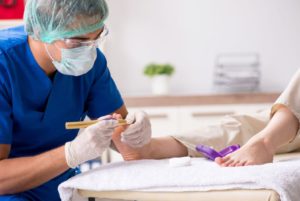 Pulling a Corn Out of Your Foot: When and How to Remove a Corn