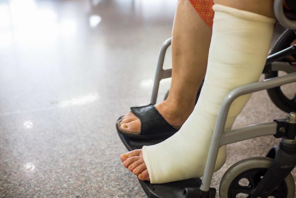 Tips for recovery after flat feet surgery