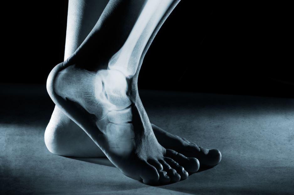 Types of flat feet surgeries​