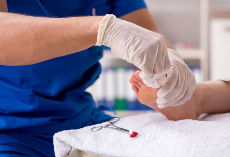 Understanding Foot Corn Surgery Benefits, Risks, and Recovery