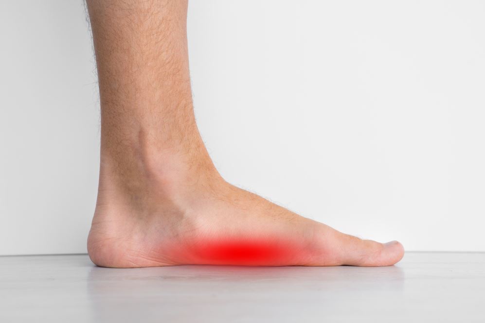 What is flat feet?