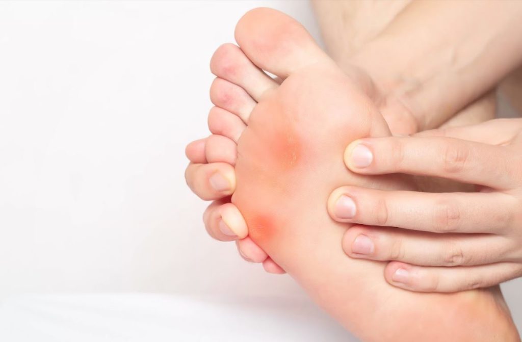 Corn on the Bottom of the Foot Causes Understanding the Factors That