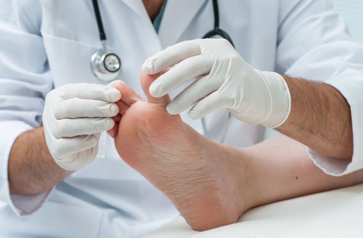 Corn Removal Surgery Miami Luxe Foot Surgery