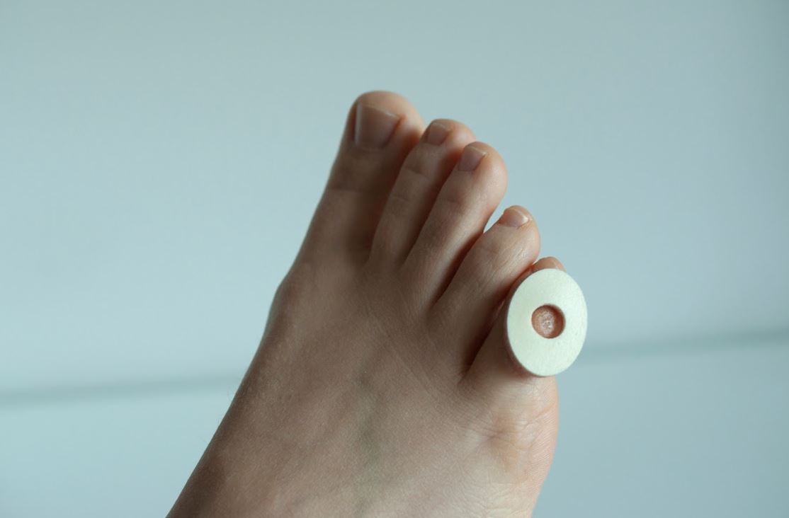 What's the Best Thing for Corns on Your Toes From a Pharmacy