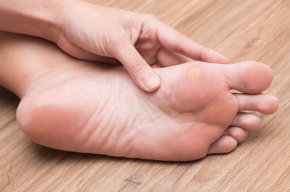 Are Corns on the Toes Painful?