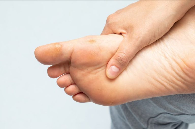Corn on the Ball of My Foot Causes, Symptoms, and Treatment Options