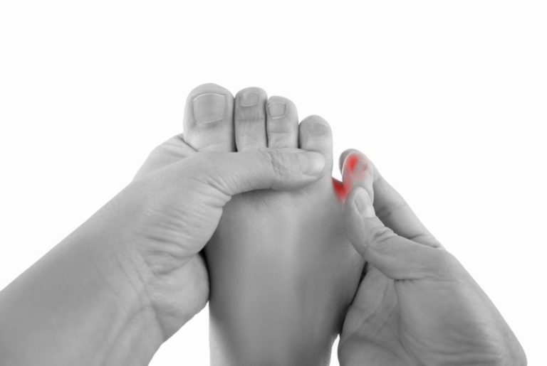 How to Get Rid of Hard Corn on Pinky Toe Fast?