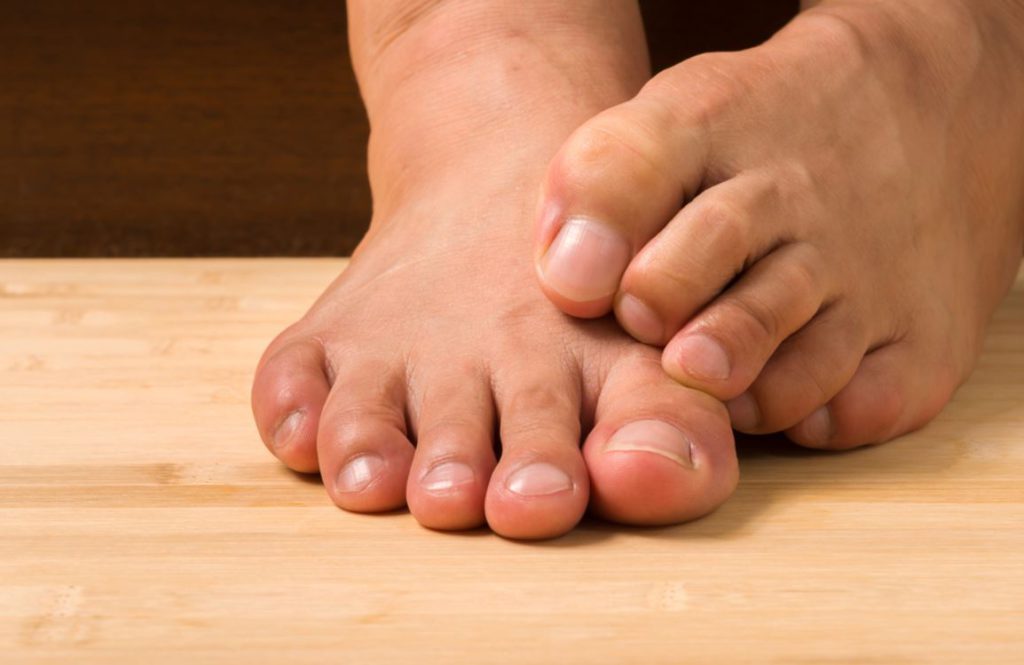 What Are Big Toe Surgery Options