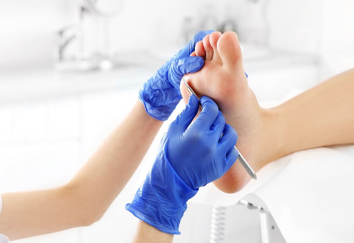 How to Permanently Remove Seed Corns