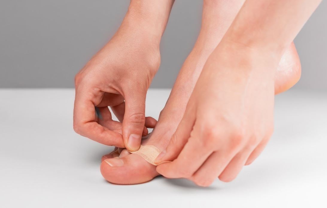 Corn on the Big Toe Symptoms, Diagnosis, and Treatment Options