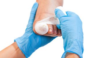 Toe Plastic Surgery Cost