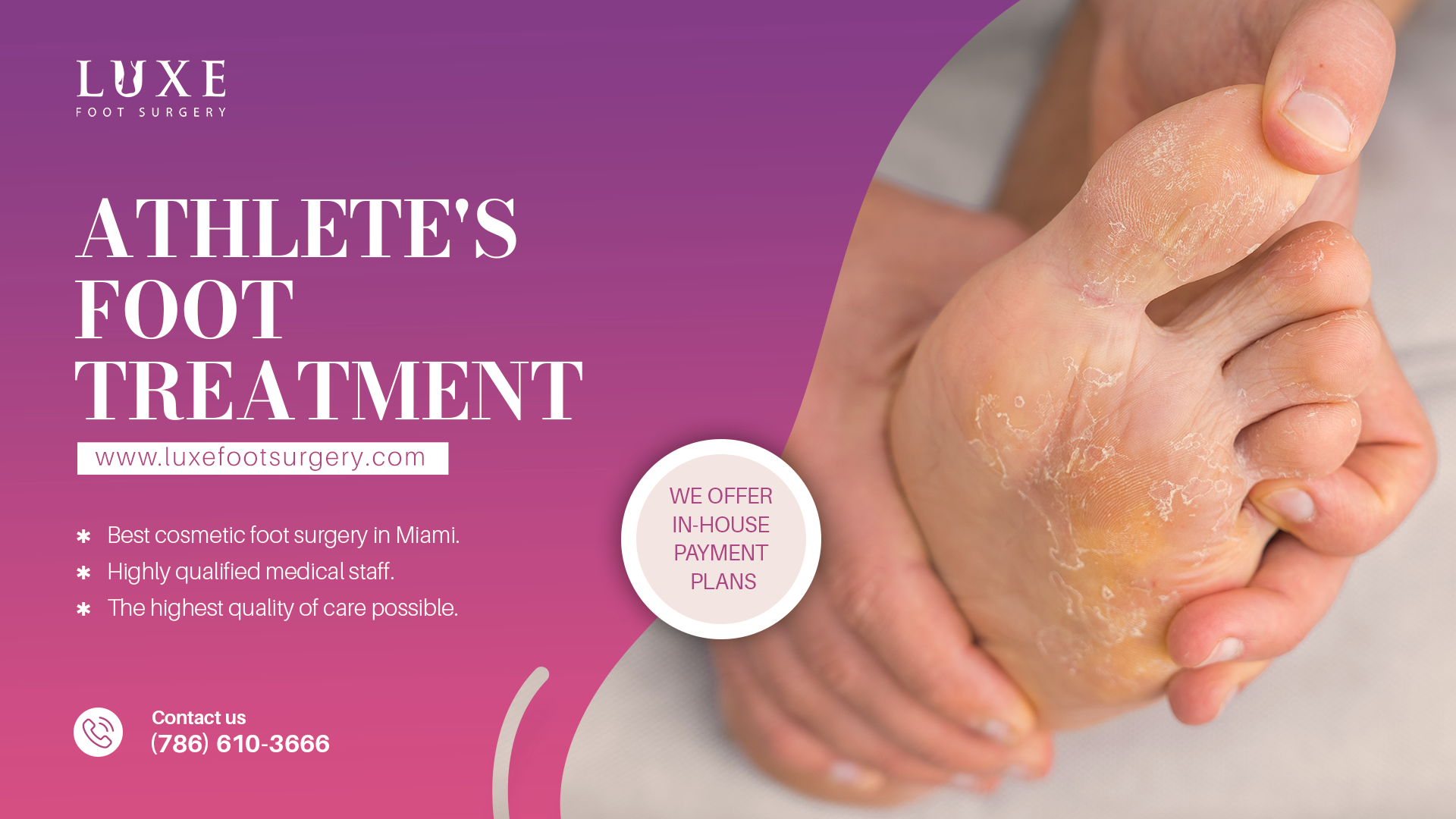 Effective Treatment for Athlete's Foot Goodbye to Fungal!