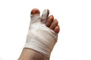 Bandaged toe with problems