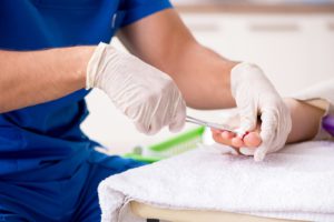 The Benefits of Hammer Toe Surgery With Toe Shortening