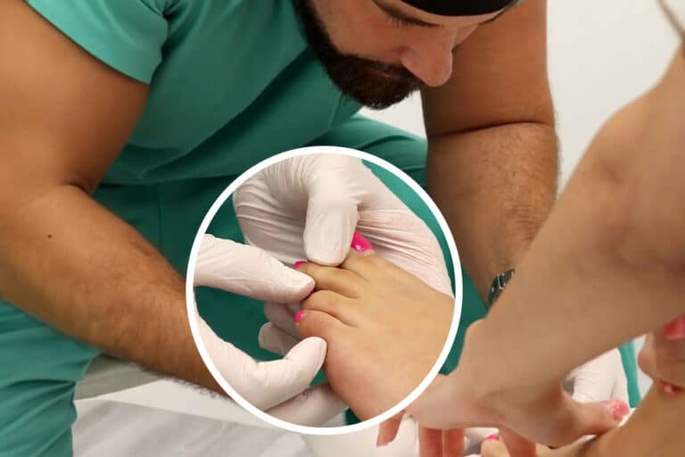 Toe Reduction Surgery Toe Shortening Surgery: Everything You Need to Know